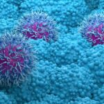 Cancro al pancreas: una volta era una condanna a morte, ora i nuovi trattamenti ci avvicinano alla cura.